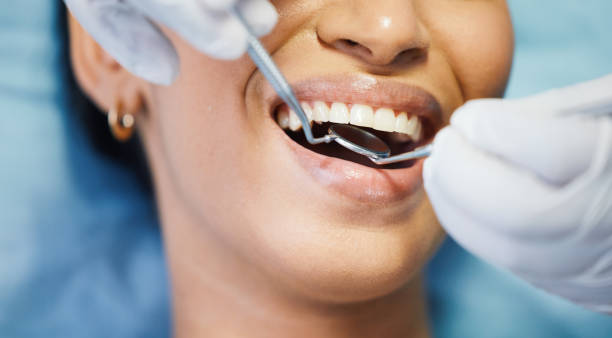 Best Emergency Broken Tooth Repair in Aberdeen, NC