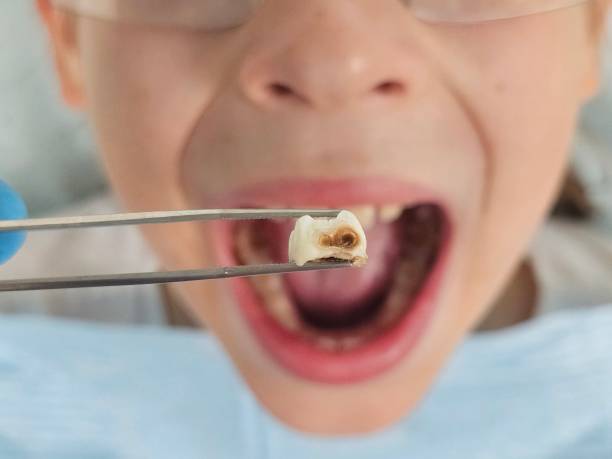 Best Emergency Broken Tooth Repair in Aberdeen, NC