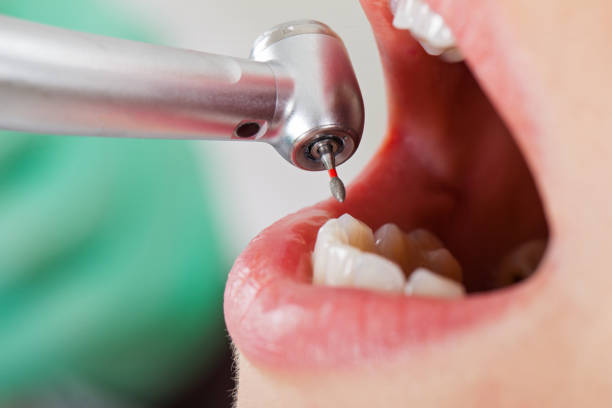 Best Same-Day Emergency Dentist in Aberdeen, NC